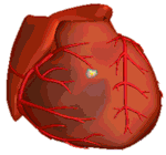 Animationsfilm zur Ablation