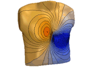 body surface potential map