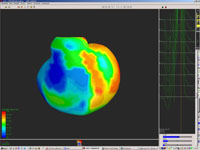 Aktivierungskarte auf dem Epicard