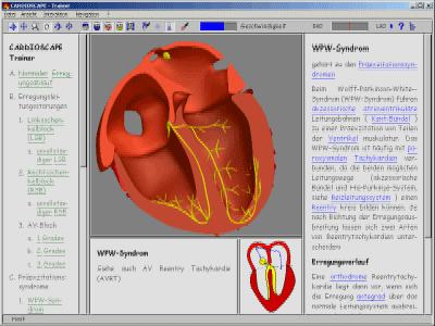 Bildschirmanzeige des WPW-Sydrom im CARDIOSCAPE-Trainer
